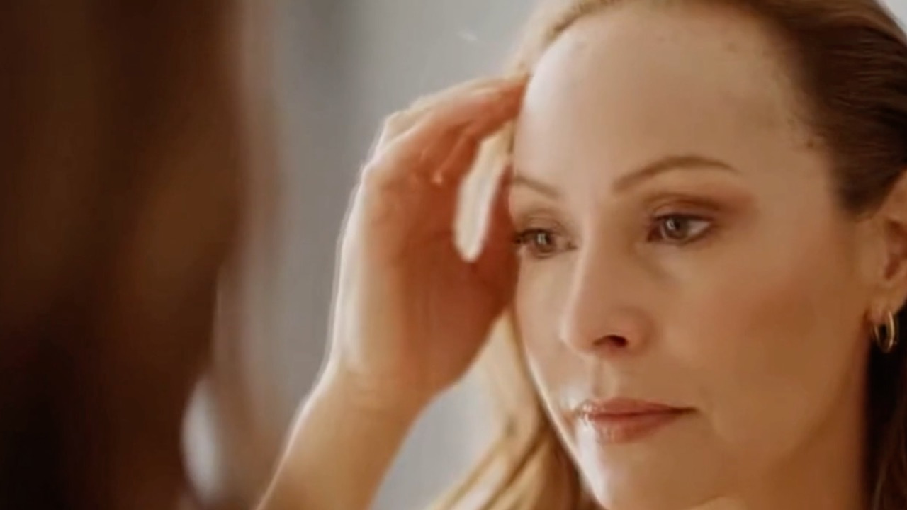 Woman with hair loss looking in a mirror