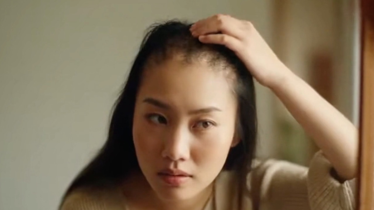 Woman with hair loss looking in mirror